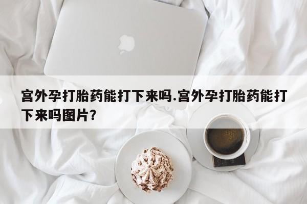 米非米索如何购买要闻 第60页